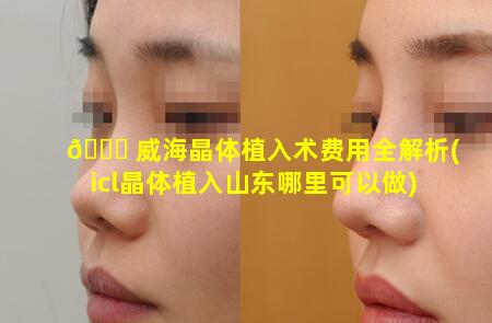 🐘 威海晶体植入术费用全解析(icl晶体植入山东哪里可以做)